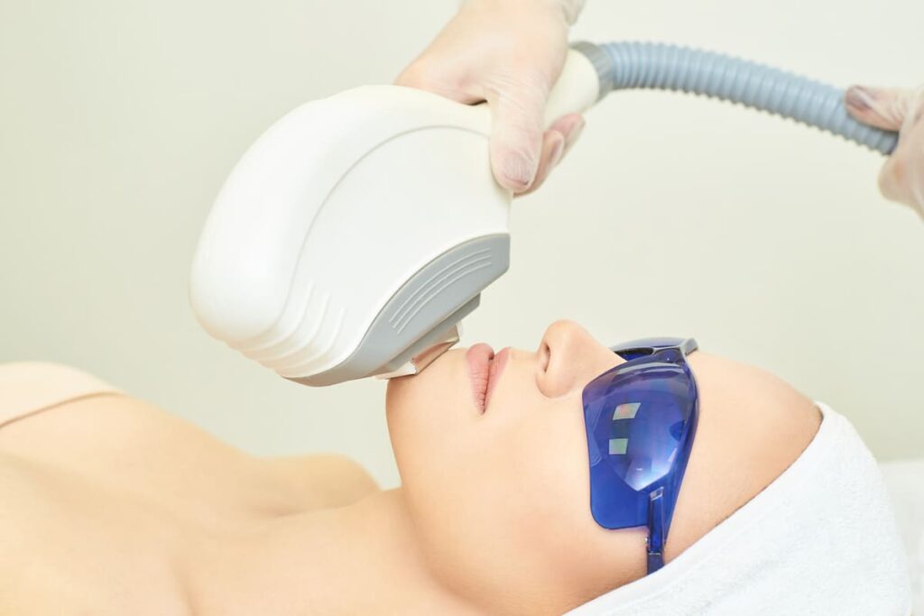 Tratamientos estéticos no invasivos: IPL